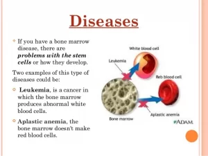 Understanding the different types of bone marrow diseases and disorders