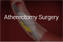 Atherectomy Surgery