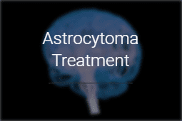 Astrocytoma Treatment